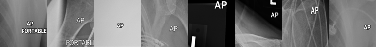 Top-activating patches: AP PORTABLE technique text