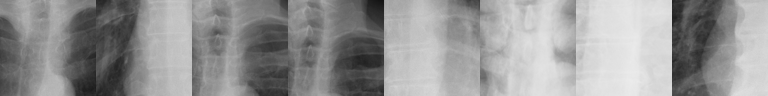 Top-activating patches: mediastinal contour