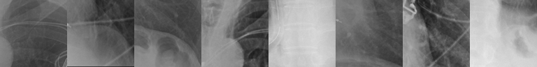 Top-activating patches: tubes and catheters