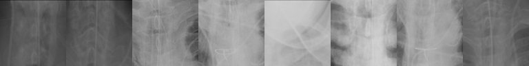 Top-activating patches: spine and paraspinal region